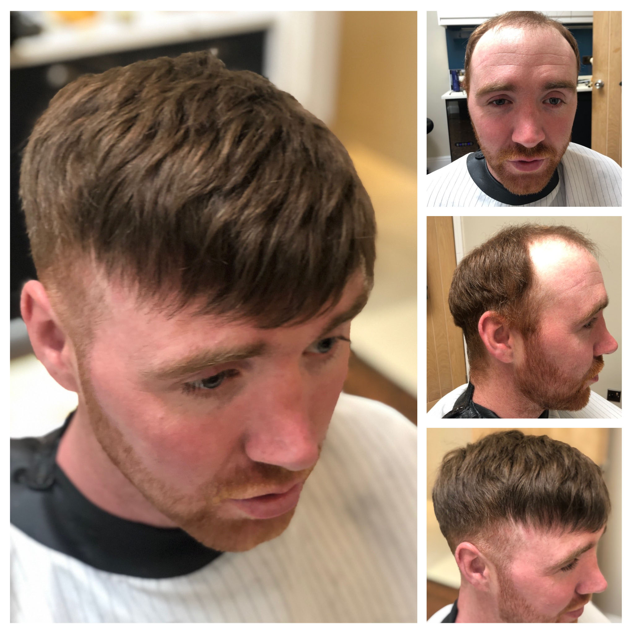 Hair Replacement System Wakefield | Blades Barbershop